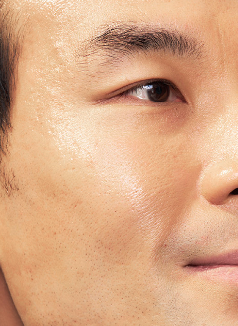 Headshot of SKINVIVE™ patient Lee, plus a close-up of his eye and cheek, with his skin looking smooth and radiant.