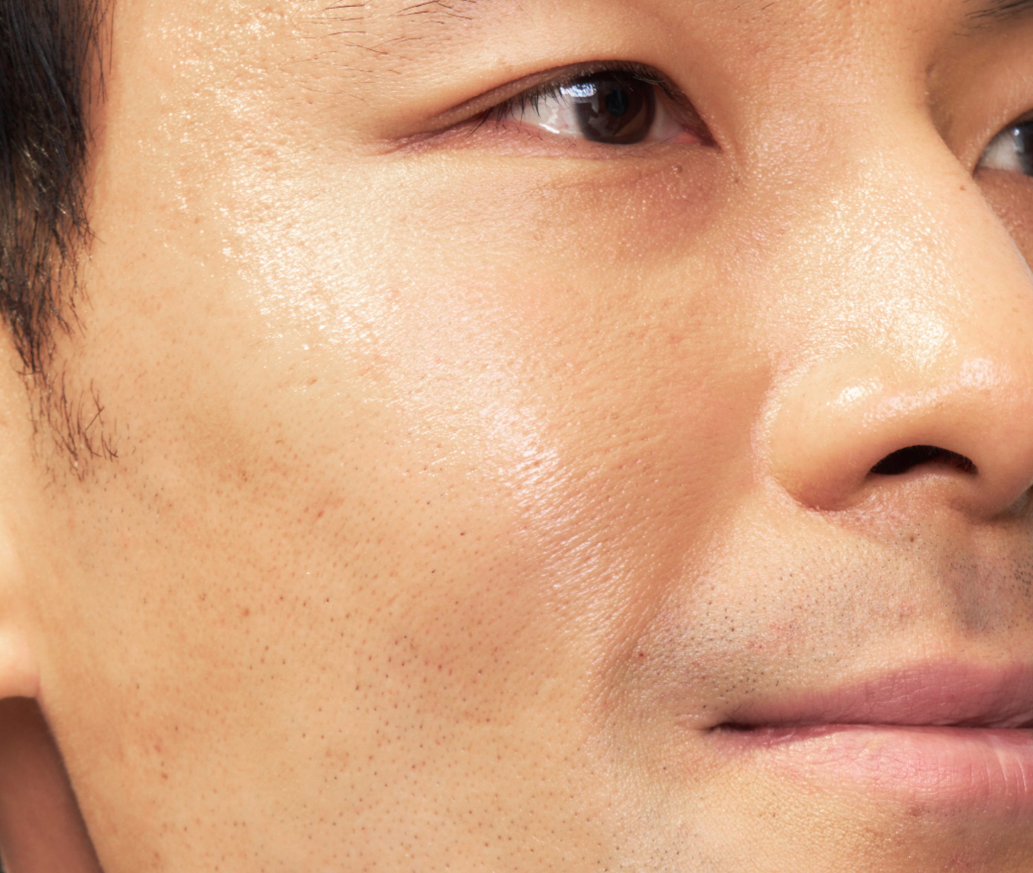 Headshot of SKINVIVE™ patient Lee, plus a close-up of his eye and cheek, with his skin looking smooth and radiant.
