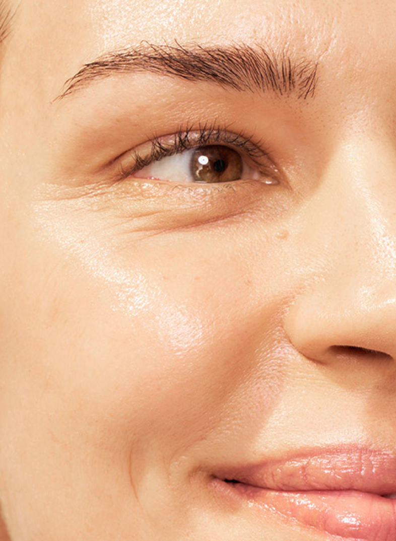 Headshot of SKINVIVE™ patient Petra, plus a close-up of her eye and cheek, with her skin looking smooth and radiant.