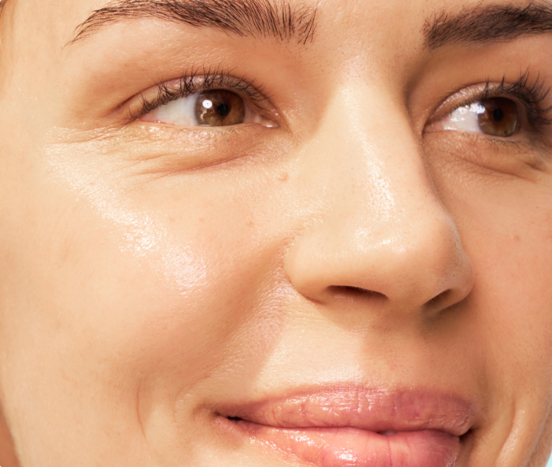 Headshot of SKINVIVE™ patient Petra, plus a close-up of her eye and cheek, with her skin looking smooth and radiant.